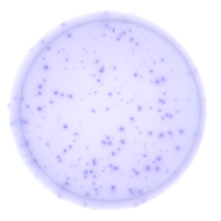 IgG B cell ELISpot plate image