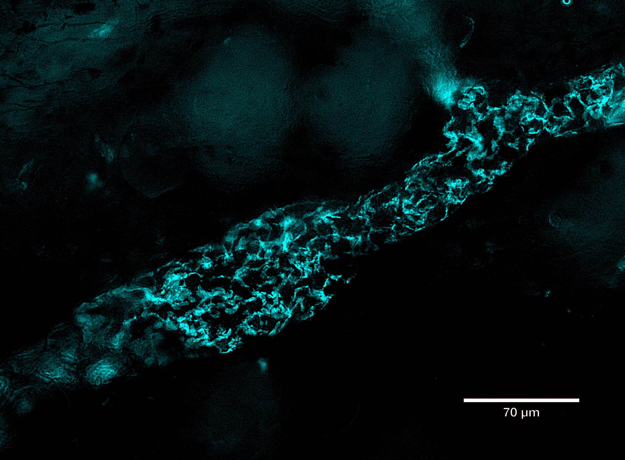 Illuminating Lymphatics: Ankyron® CJ30451 Reveals LYVE1 with Unmatched Precision
